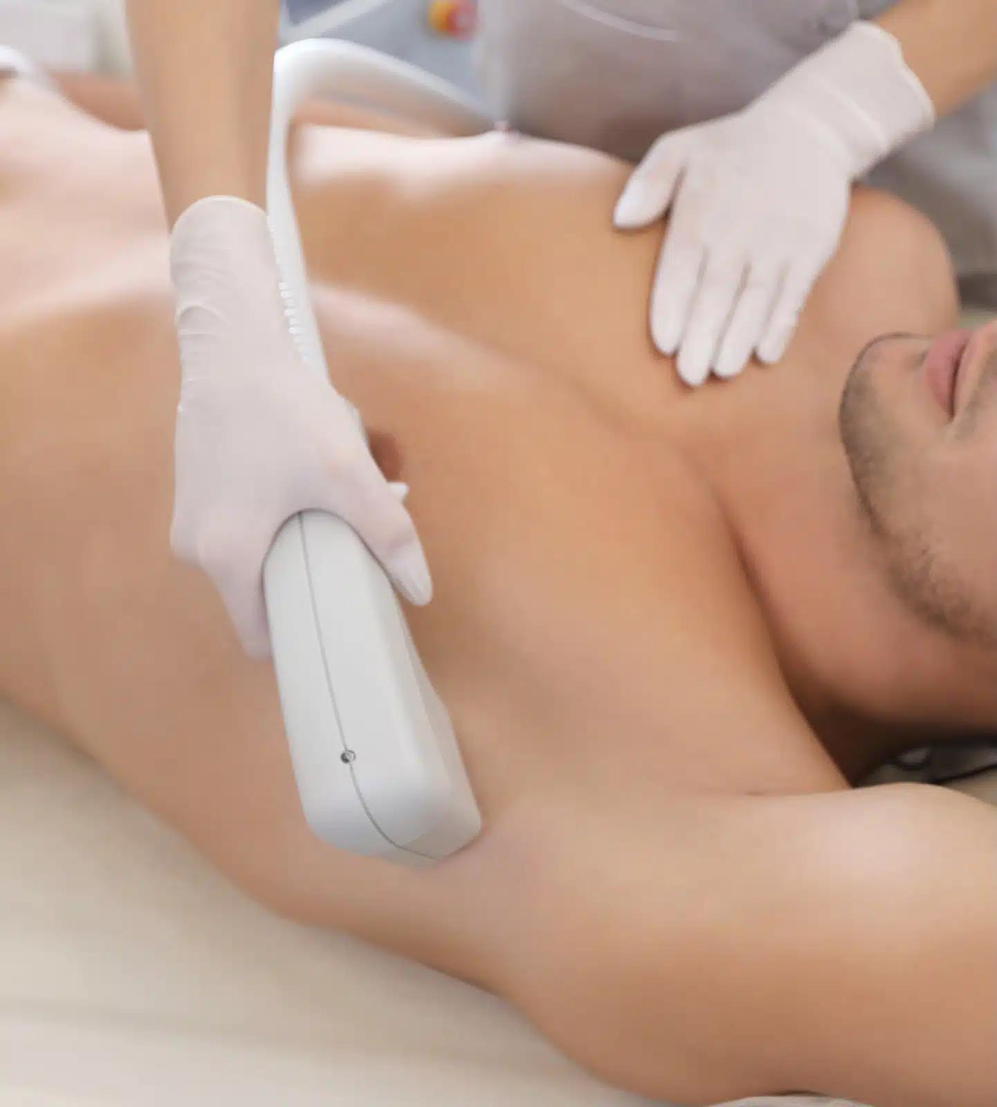 man receiving laser hair removal