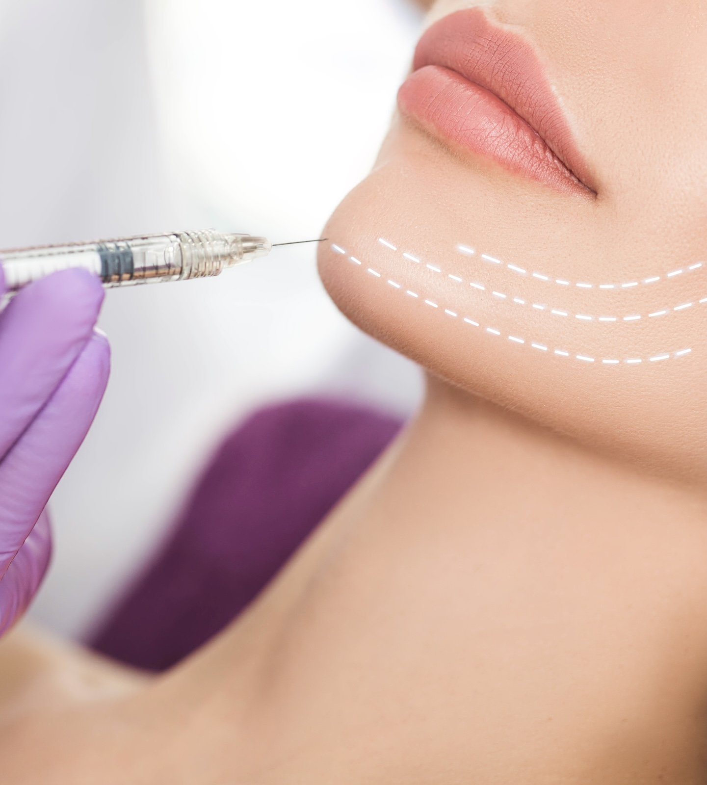 woman receiving kybella injection