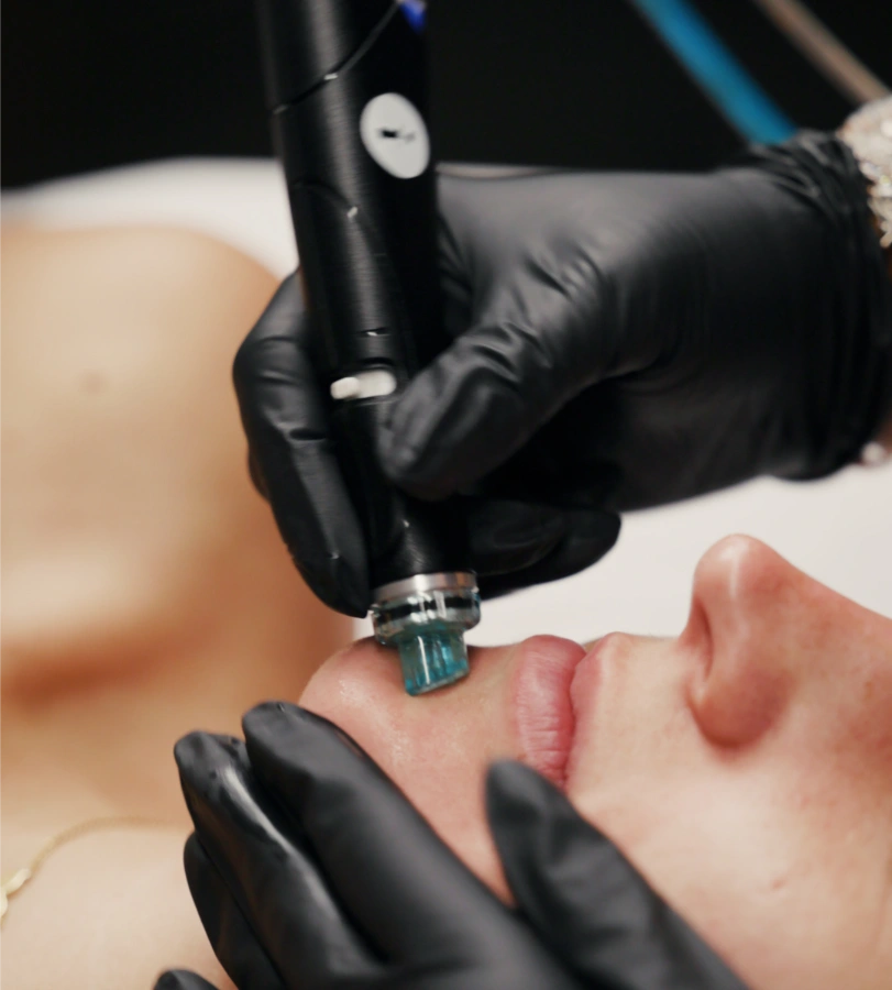 esthetician giving hydrafacial treatment to patient at glow medical spa