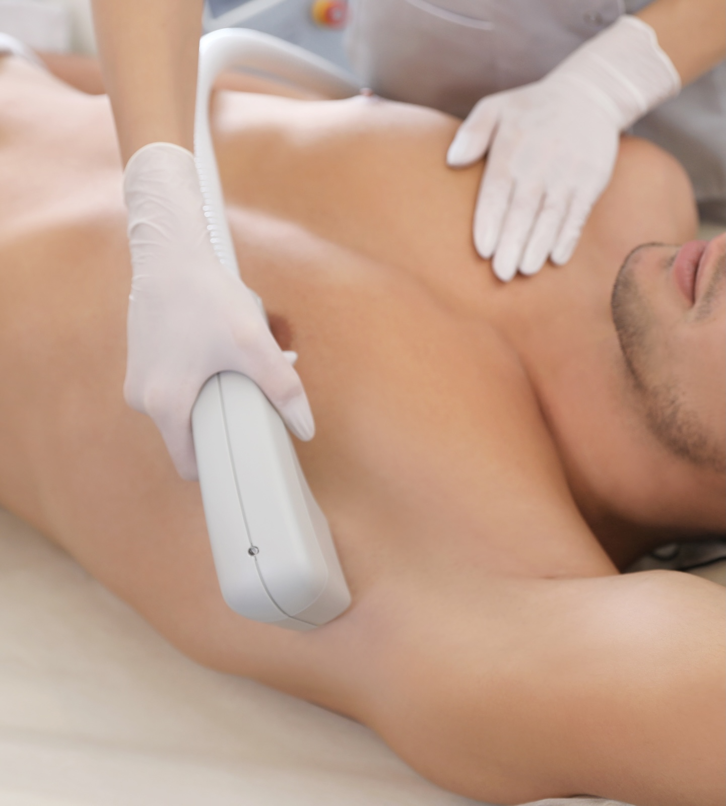 man receiving laser hair removal