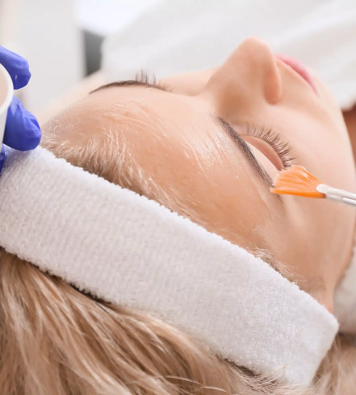 woman receiving chemical peel treatment