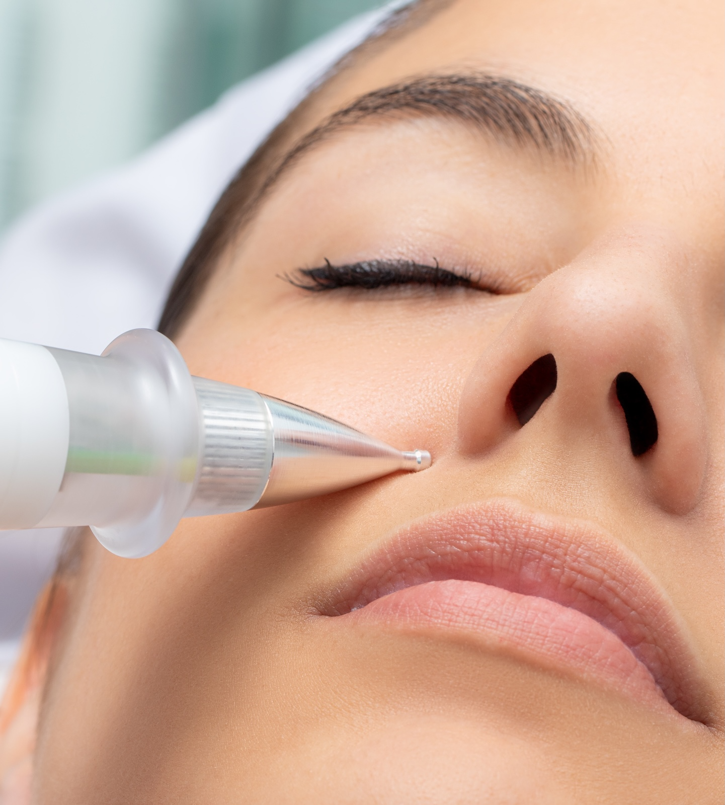 woman receiving plasma skin tightening treatment